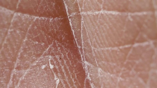 White detailed caucasian human skin closeup in macro