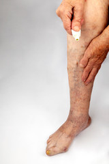 Fototapeta premium Varicose veins in the legs. Inflammation of the joints of the lower extremities in an elderly person. Phlebeurysm. To smear feet with ointment.