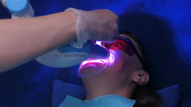 LED whitening beauty cosmetic procedure for woman's teeth in dentistry clinic. Nurse adding gel to teet during treatment, hands closeup. UV lamp, bleaching in protective eyes, face closeup.