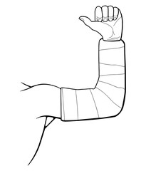Male hand in a plaster cast. Fracture and healing. Vector illustration.