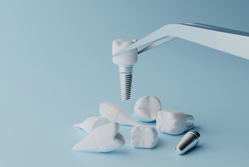 3D rendering Dental implantation concept. Human teeth or dentures tools.