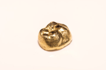 Zahngold, goldene Krone (Altgold)