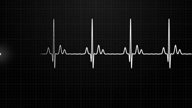 Loopable: White EKG/ECG cardiogram oscilloscope monitor heartbeat line chart shows 60 BPM heart rate on black background with grid.
