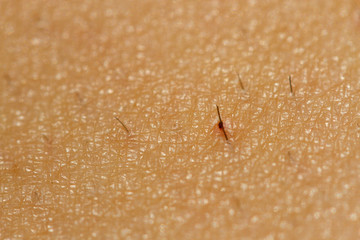 Close up skin with hairs