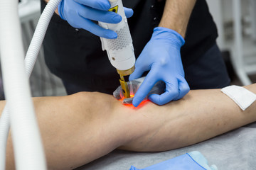 Doctors doing vein surgery procedure