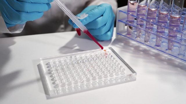 Immunological blood test. A laboratory assistant in a modern place makes a blood test