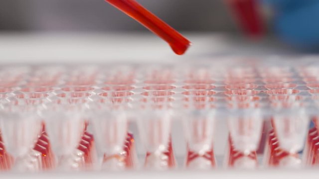 The doctor analyzes the blood samples of patients. Dripping blood into cells on an immunological tablet