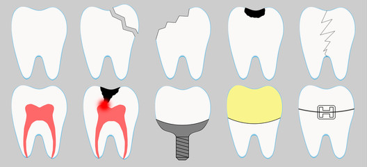 Set of cute cartoon tooth icons. Different tooth conditions. Healthy and bad teeth. Dentist and stomatology icon collection - orthodontics, caries, implant, crown, pulpits, fracture