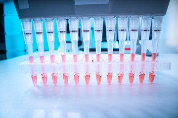 sample of biological sample for DNA analysis