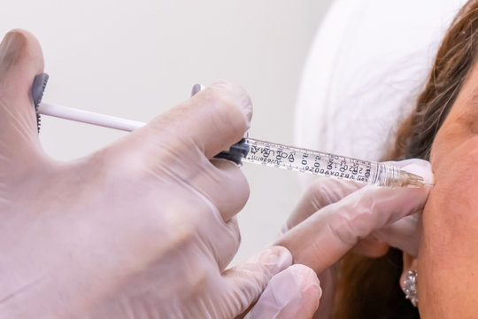 Gloved doctor hand injecting a vial of hyaluronic acid (HA) based dermal filler into patient for a non-surgical cheek and face lift.