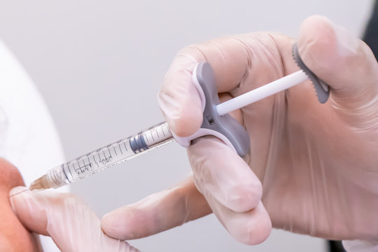 Gloved doctor hand injecting a vial of hyaluronic acid (HA) based dermal filler into patient for a non-surgical cheek and face lift.
