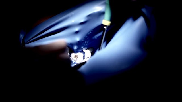 mano doctor raspando diente