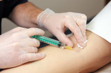 The doctor injects a syringe under the knee. A doctor makes an injection to the varicose veins on a woman s leg, close-up, sclerotherapy, stripping, phlebeurysm, medical.