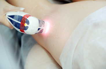 Man on laser hair removal procedure in a beauty salon. Hair removal concept