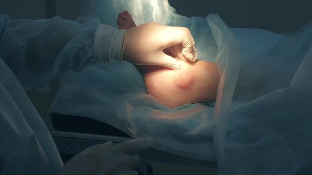 Surgeon man in sterile gloves palpates leg before surgery to remove ankle hygroma in joint, hands closeup. One day surgery concept. Examination before operation. Woman patient in hospital with doctor.