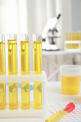 Test tubes with urine samples for analysis on white table in laboratory