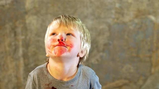 little fair-haired boy is smeared with blood. baby has weak vessels in nose bursting with pressure drops and changes in weather. Hemophilia disease. Blond child lifts his head to stop the bleeding