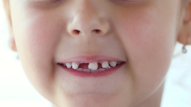 The child shows a wobbling baby tooth. Shakes a tooth language. He touches the tooth with his hand. Toothless smile. The girl tries to pull out a tooth herself. Close up
