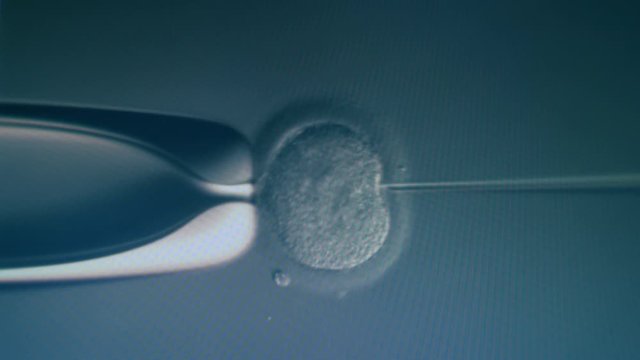 Egg cell is getting fertilized under a microscope. IVF, extracorporal fertilization process
