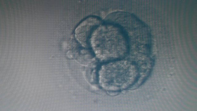 Eight-cell embryo demonstrated under a microscope