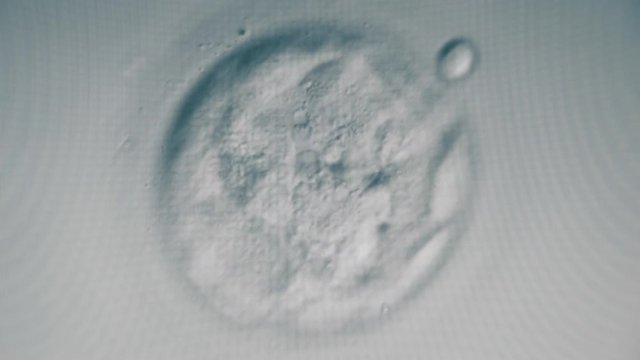 Magnified image of a fertilized egg cell. Artificial insemination in a scientific laboratory.