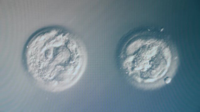Fertilized egg cells are being analyzed under a microscope