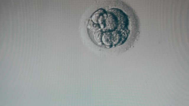 Impregnated egg cell shown under a microscope