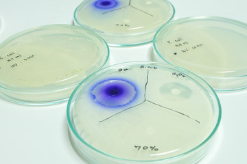 colony of bacteria in petridish