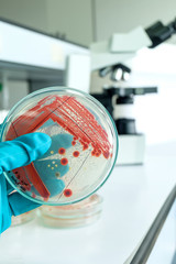 red colony of bacteria in laboratory