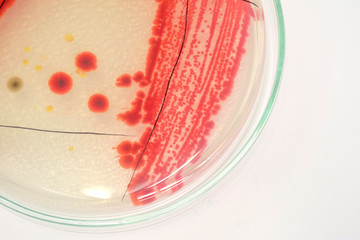 red colony of bacteria in laboratory