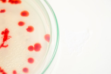 red colony of bacteria in laboratory