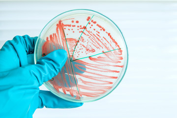 red colony of bacteria in laboratory