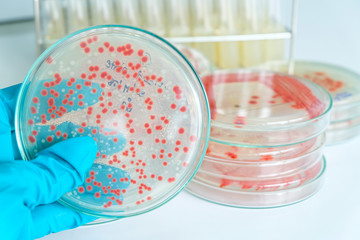 red colony of bacteria in laboratory