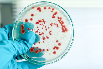 red colony of bacteria in laboratory