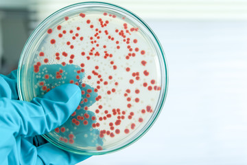 red colony of bacteria in laboratory