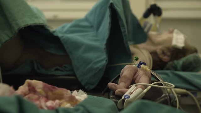 Hands of female patient under anesthesia while lying on surgical table .