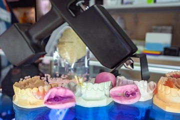 Dentistry. Colorful model of the jaw of the person. Correction of bite. Implantation. The installation of the prostheses. Dental pins. Preparation for dental treatment.