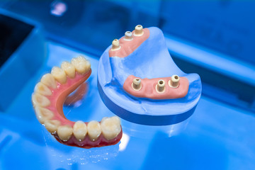 Dentistry. Model of human jaw on a blue background. Medical aid for the instruction of students. Denture. Manufacturing of prostheses. Dental office. Medical Institute. © Grispb