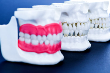 Fototapeta na wymiar Human jaws with teeth and gums anatomy models