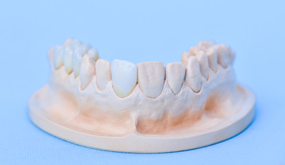 Fototapeta na wymiar Gypsum model of human jaw