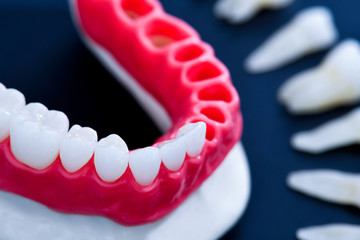 Tooth implant and crown installation process