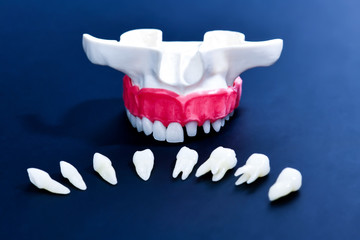 Fototapeta na wymiar Tooth implant and crown installation process