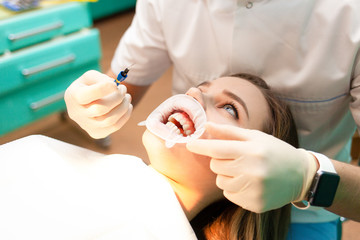 Patient with cheek retractor lies on the dental chair during the procedure  teeth whitening