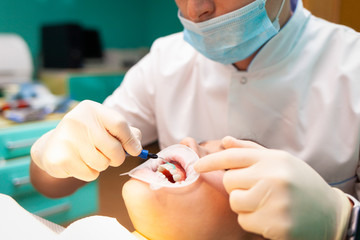 Patient with cheek retractor lies on the dental chair during the procedure  teeth whitening