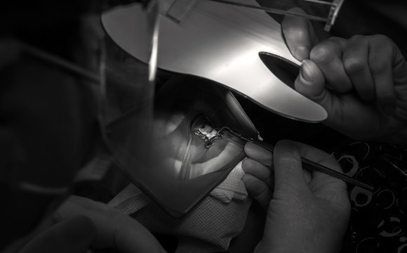 tdentistry. dental treatment, close-up. teeth and caries.