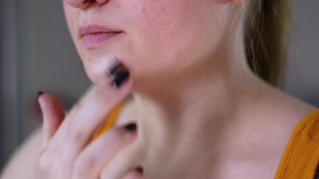 High quality HD video. Woman covers pimple with foundation.  Problematic skin on the face, acne and post-acne. The girl is trying to hide a pimple on her face.