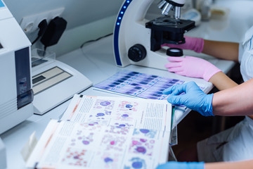 Studying tests in the laboratory. Smears. Microscope.