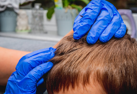 Checking The Child's Hair. Health And Pharmaceutical Concept, Child Health Problems. The Doctor Checks The Child's Hair, Head Lice, Possible Lice Infection.