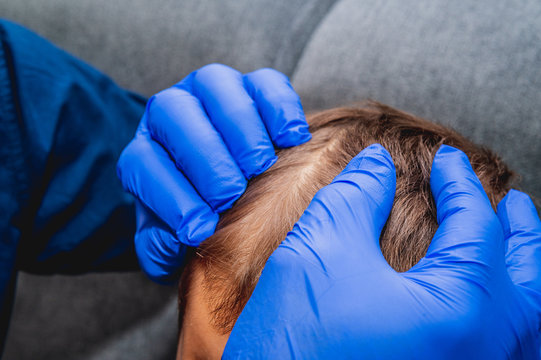 Checking the child's hair. Health and pharmaceutical concept, child health problems. The doctor checks the child's hair, head lice, possible lice infection.