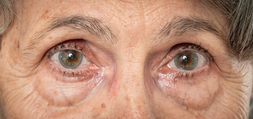close-up macro shot of elderly womans eyes